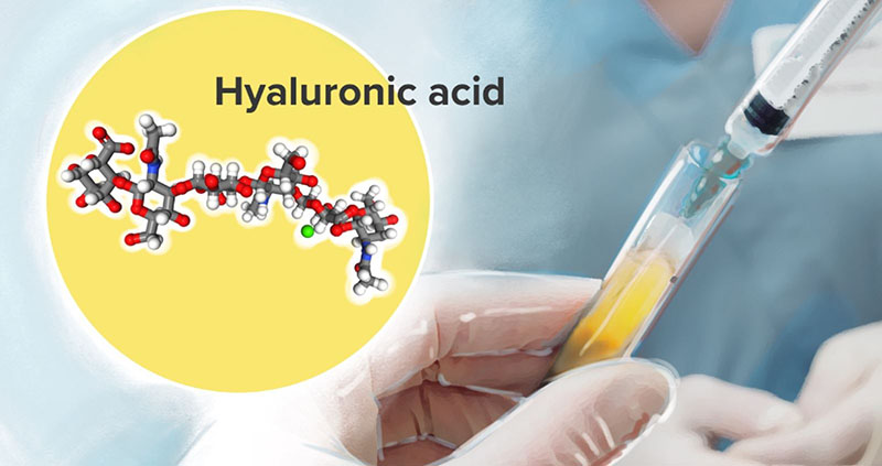 Thuốc khô khớp Acid hyaluronic hoạt động như một chất đệm hoặc chất bôi trơn trong ổ khớp