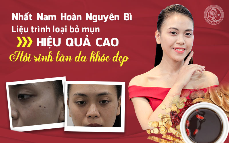 Làn da của bạn Trang đã được “hồi sinh” nhờ liệu trình xử lý mụn hất Nam Hoàn Nguyên Bì
