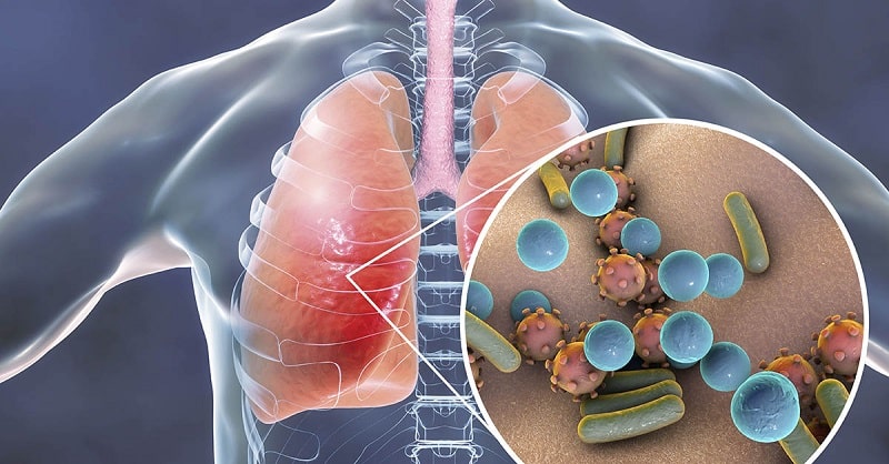 Người mắc bệnh phổi thường xuyên có cảm giác khó thở, thở hụt hơi