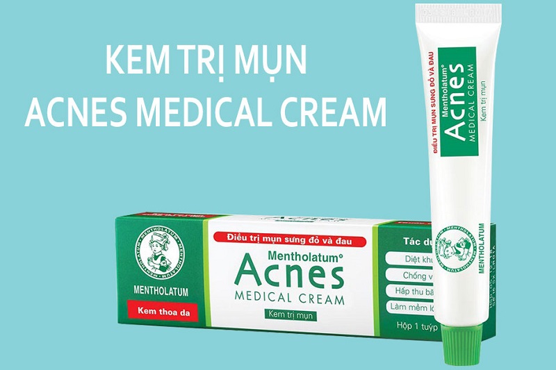Acnes Medical Cream giúp chị em loại bỏ nỗi lo mọc mụn khi mang thai