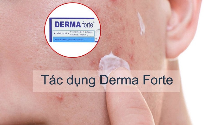 Không phải ai cũng dùng được Derma Forte
