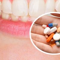 Top 7 Loại Thuốc Chữa Viêm Chân Răng Được Dùng Phổ Biến Nhất