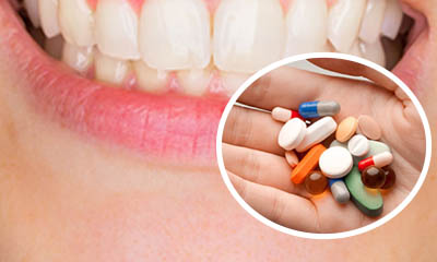 Top 7 Loại Thuốc Chữa Viêm Chân Răng Được Dùng Phổ Biến Nhất