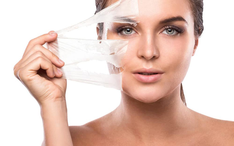 Peel da là cách chăm sóc da mặt bị nám hiệu quả nếu thực hiện đúng