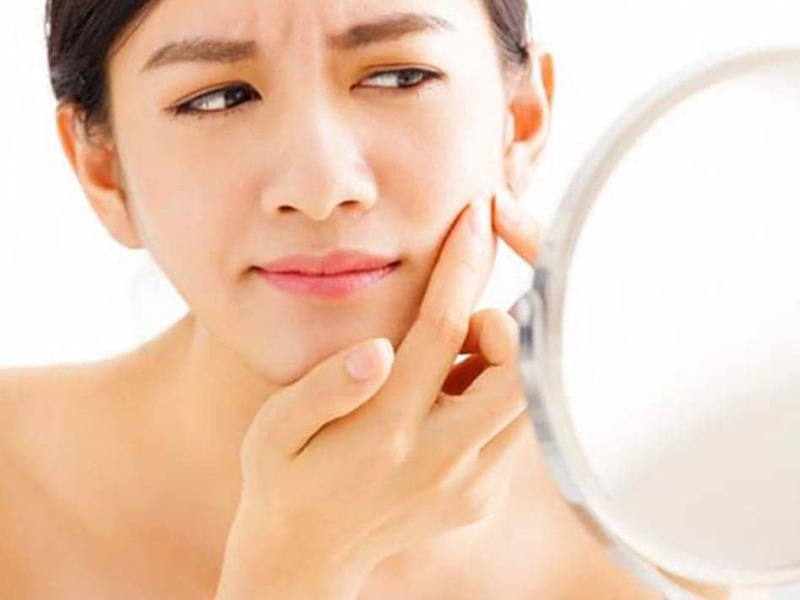 Nhiều đồn đoán về khả năng uống collagen bị nổi mụn trên da