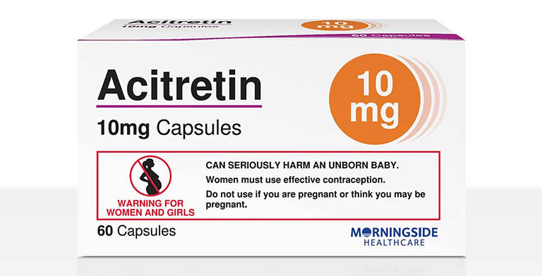 Thuốc Acitretin sẽ được kê đơn điều trị bệnh vảy nên ở mức độ nặng