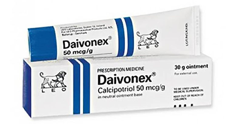 Điều trị bệnh vảy nến da đầu bằng kem bôi Daivonex