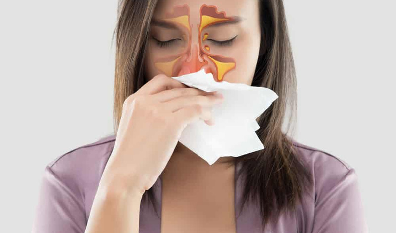 Người bị viêm mũi bị ứng có nguy cơ cao mắc tổ đỉa