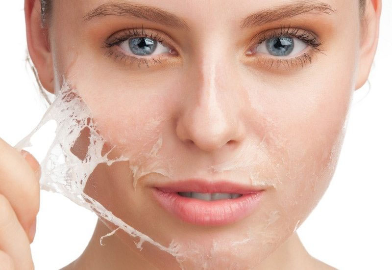 Peel tái tạo da sử dụng hoạt chất tác động vào da