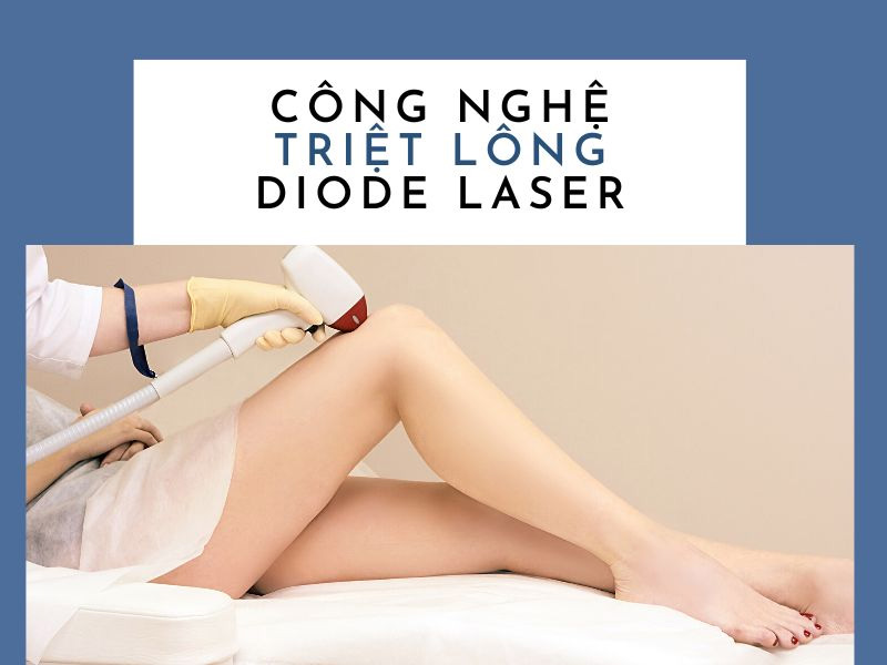 Phương pháp triệt lông Diode Laser hiện đang rất phổ biến